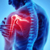 Ticket for Pain Free with FM4 Workshop